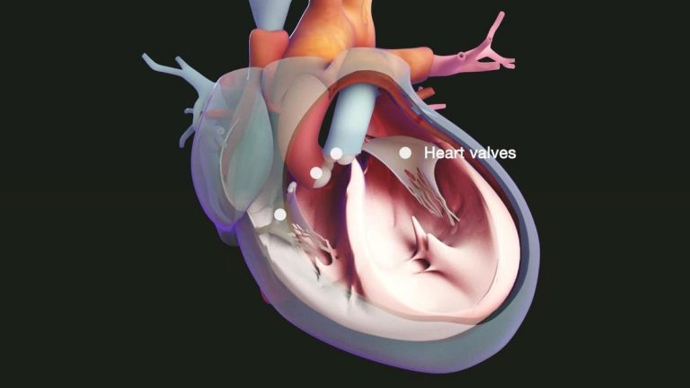 Why does the heart valve dilate?